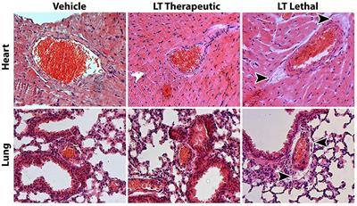 Inhibition of <mark class="highlighted">Rac1 GTPase</mark> Decreases Vascular Oxidative Stress, Improves Endothelial Function, and Attenuates Atherosclerosis Development in Mice